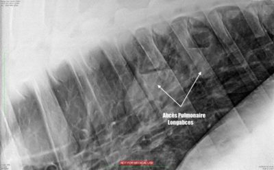 L'abcès pulmonaire chez le cheval