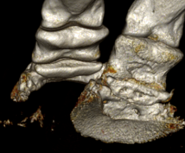 scan 3D d’une sévère de l’os naviculaire du cheval