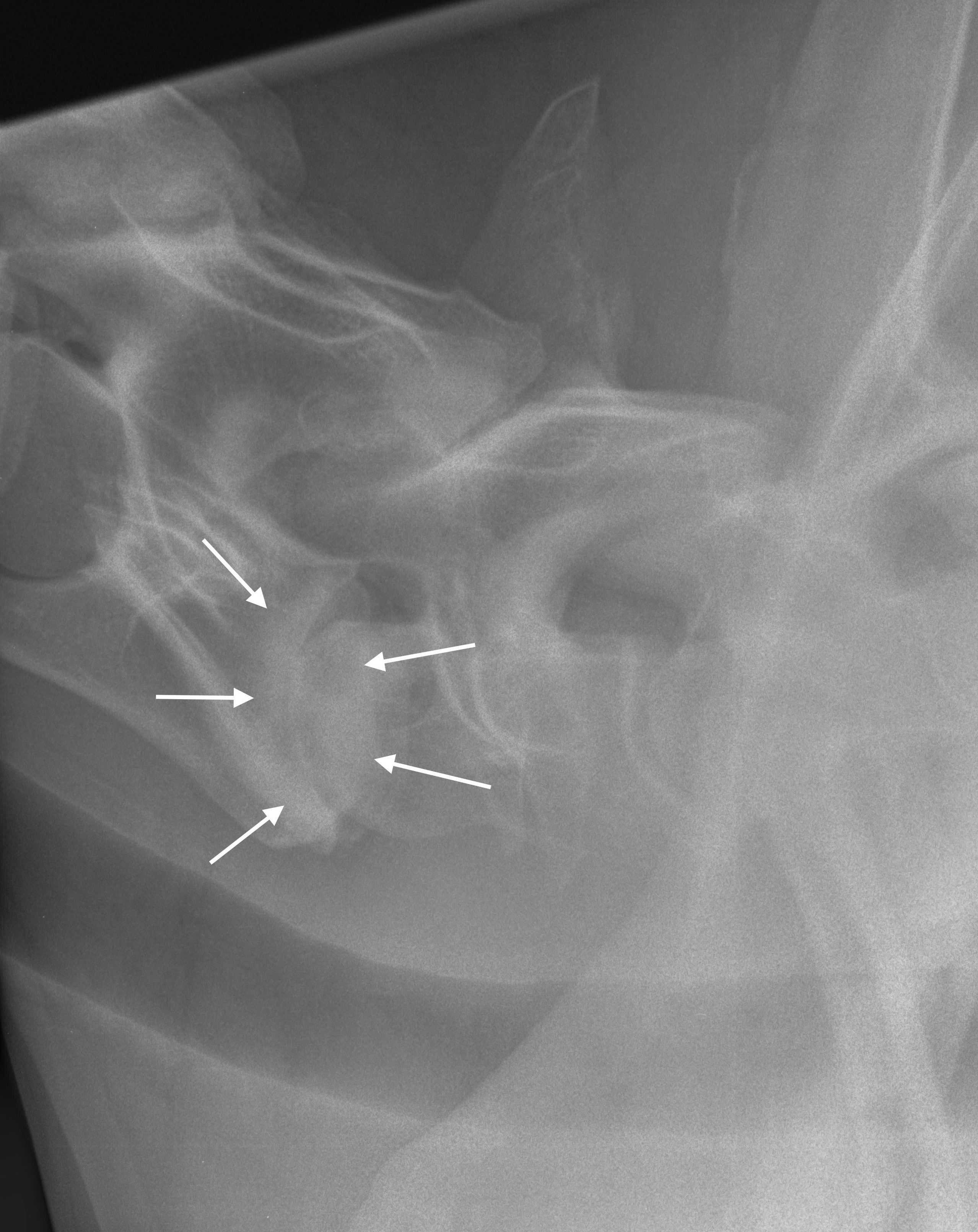 La radiographie du cou avec arthrose sévère chez le cheval