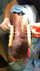 Explications techniques des fractures chez le cheval