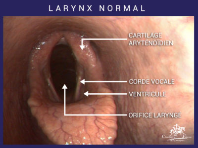 Larynx normal du cheval