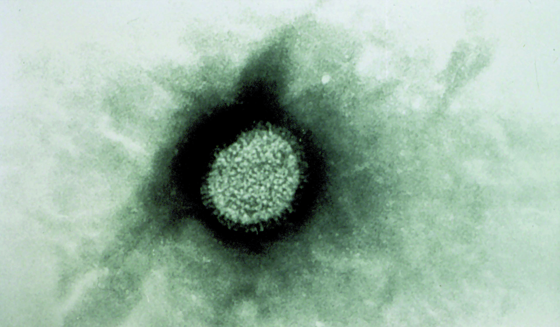 Le virus de la grippe chez le cheval